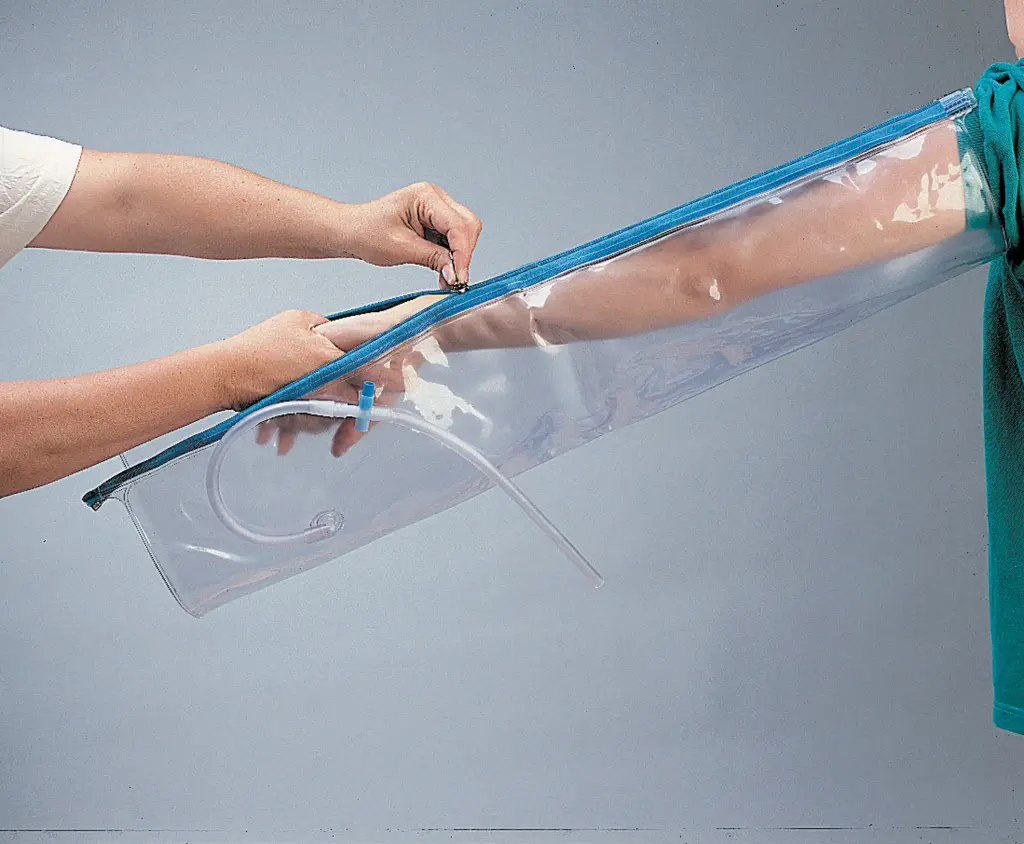 Urias®-Johnstone splint for the arm (single room)