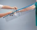 Attelle Urias®-Johnstone pour le bras (chambre simple)