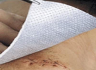 Metalline compresses, 8 x 10 cm, sterile - Box of 10