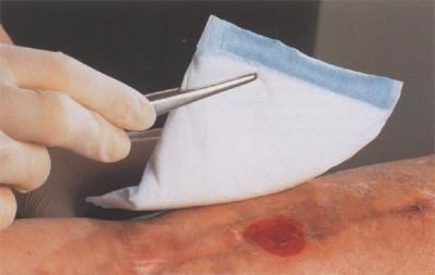 Vliwazell absorbent compresses - Sterile