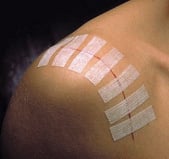 Bandes adhésives 3M Steri-Strip