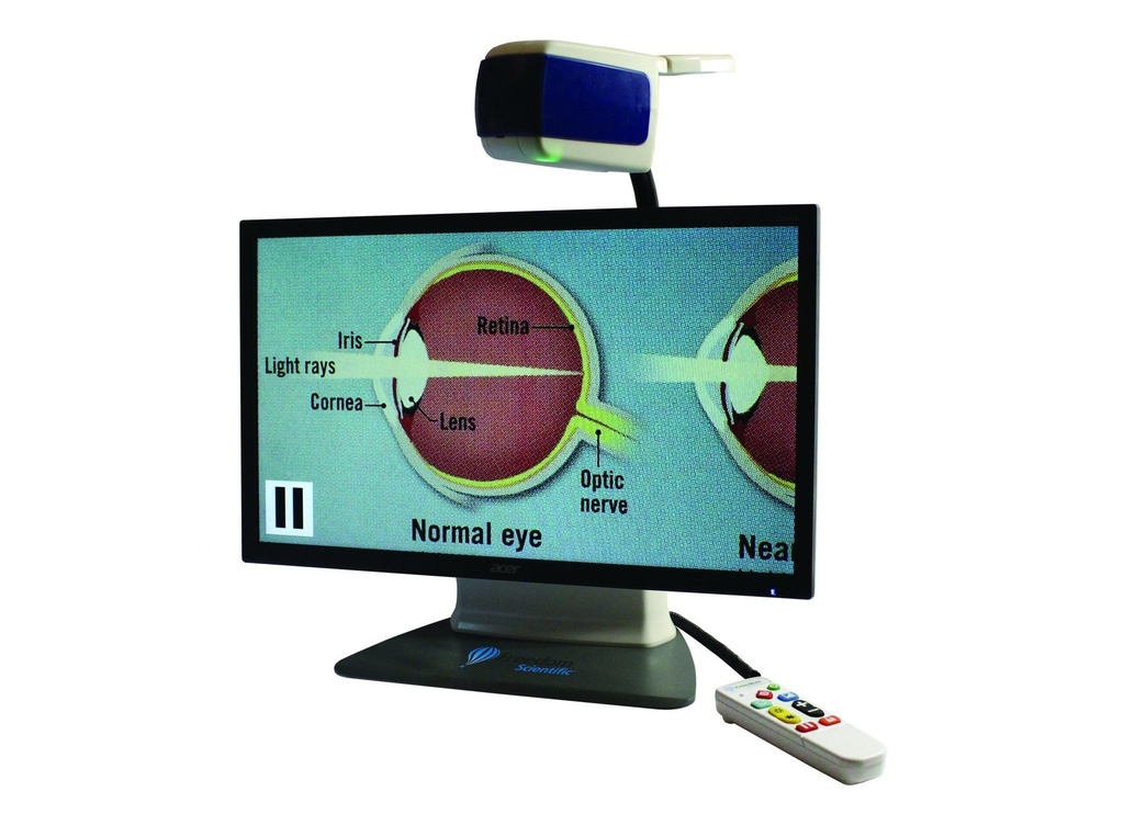 Loupe vidéo portable